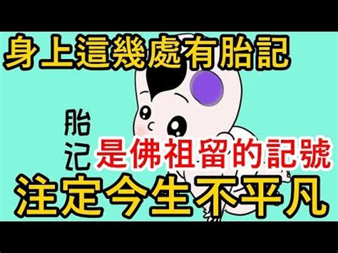 胎記位置屁股|胎記怎麼產生、何時消除？醫師剖析胎記種類、胎記寓意